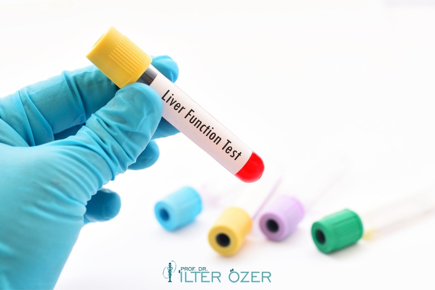 Liver Function Tests