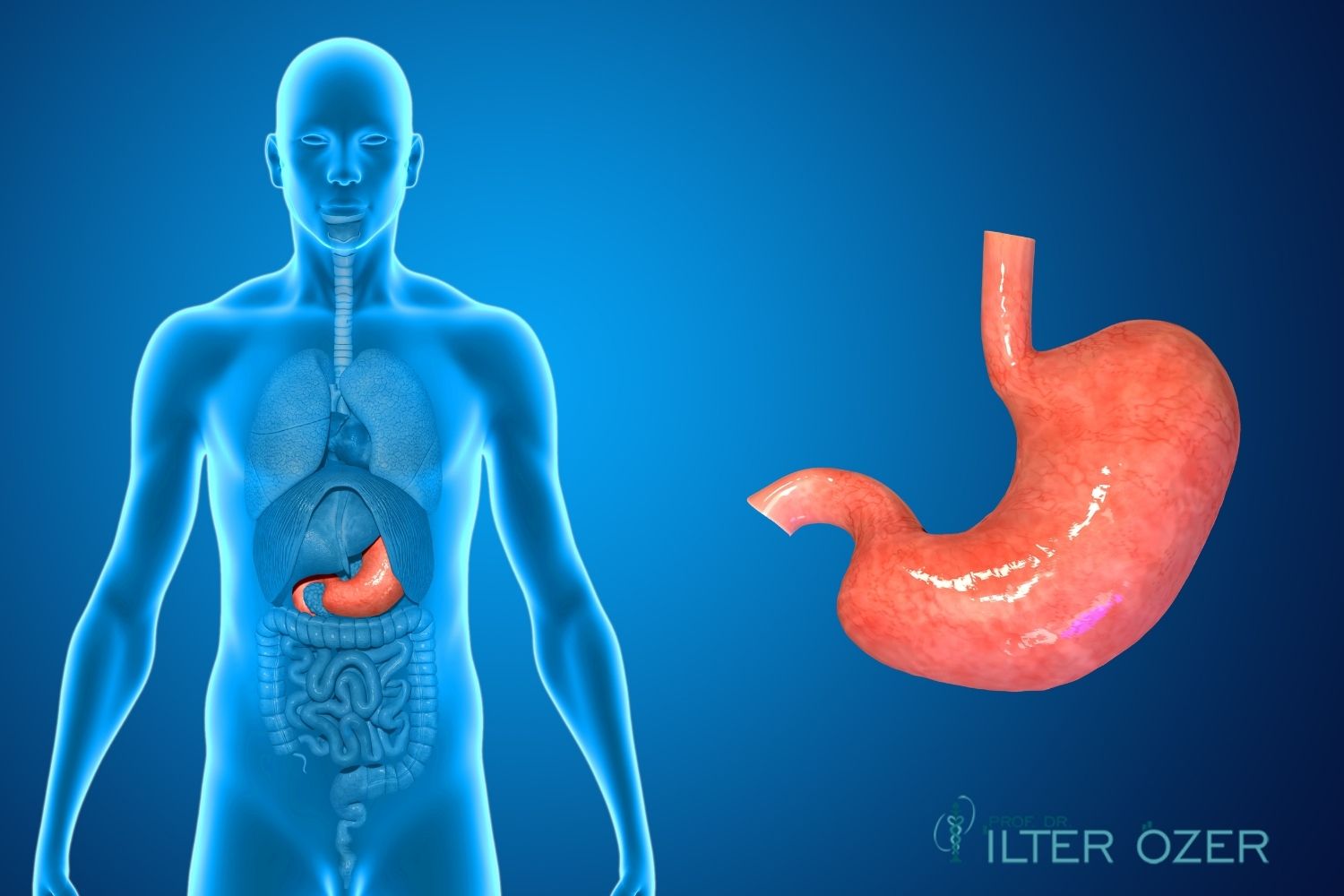Stomach Cancer Surgery