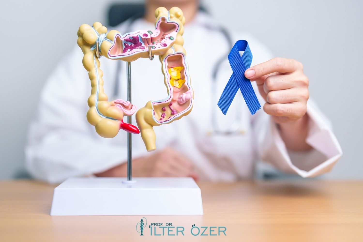Colon Cancer Liver Metastasis Life Expectancy