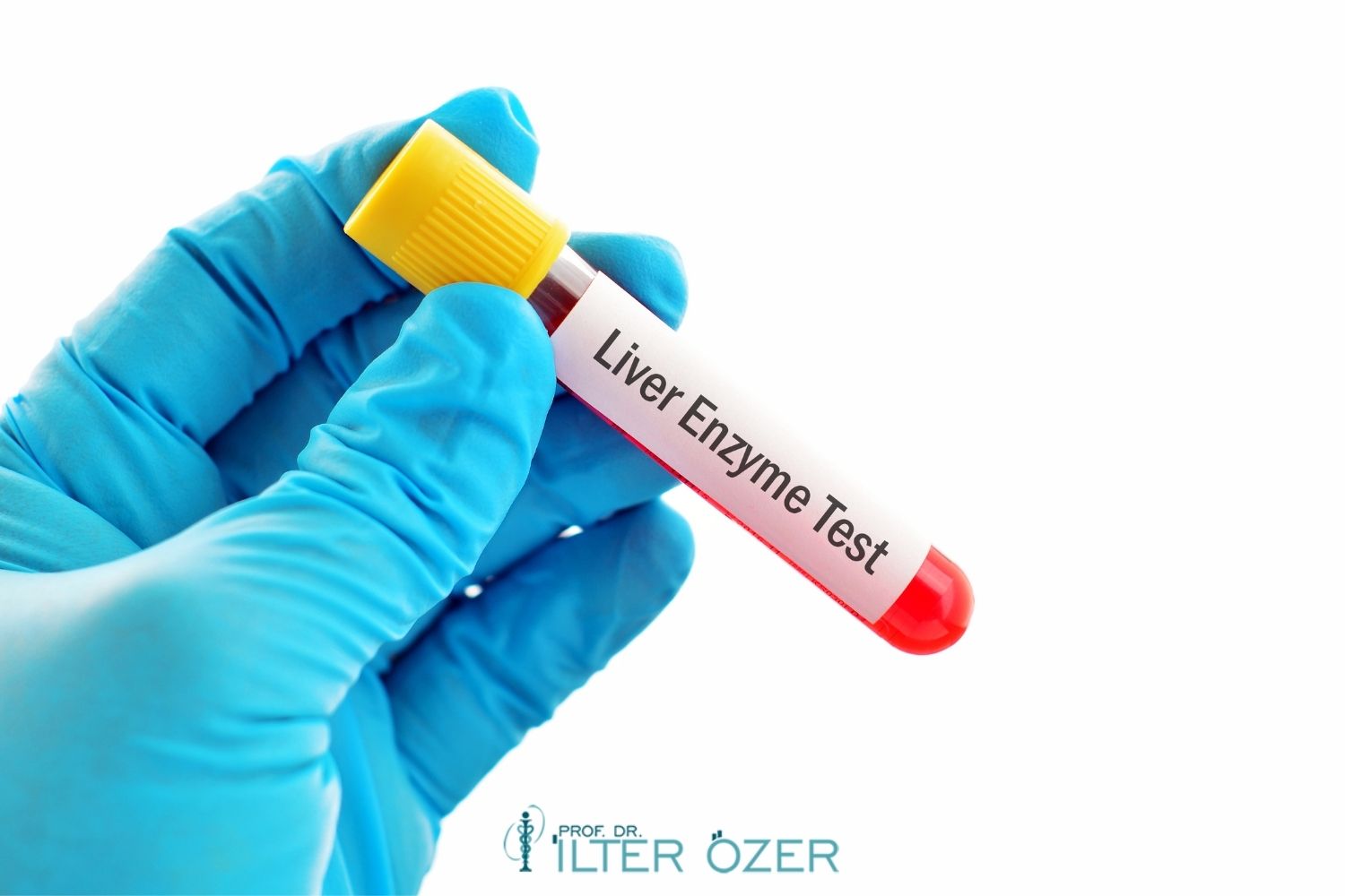 Why Do Liver Enzymes Increase? What Are the Symptoms?