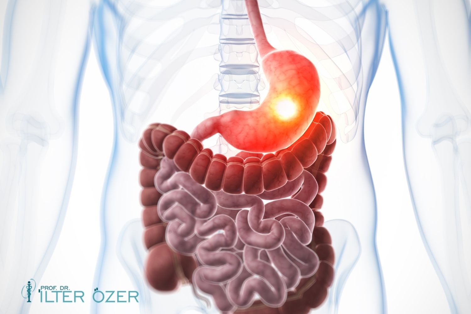 What Causes Stomach Cancer?