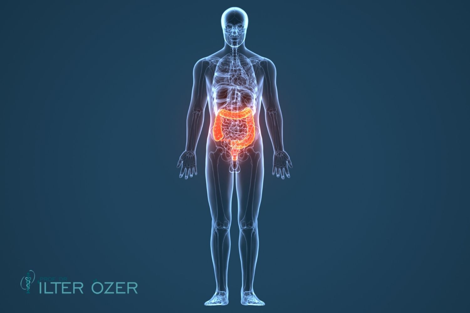 Stomach and Colon Cancer Symptoms