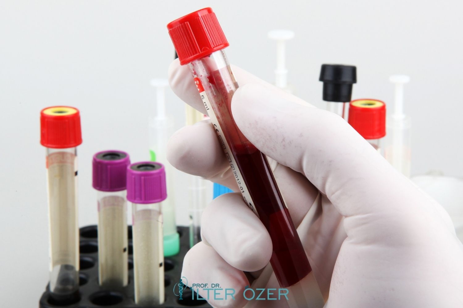 Which Blood Test Values Indicate Cancer?