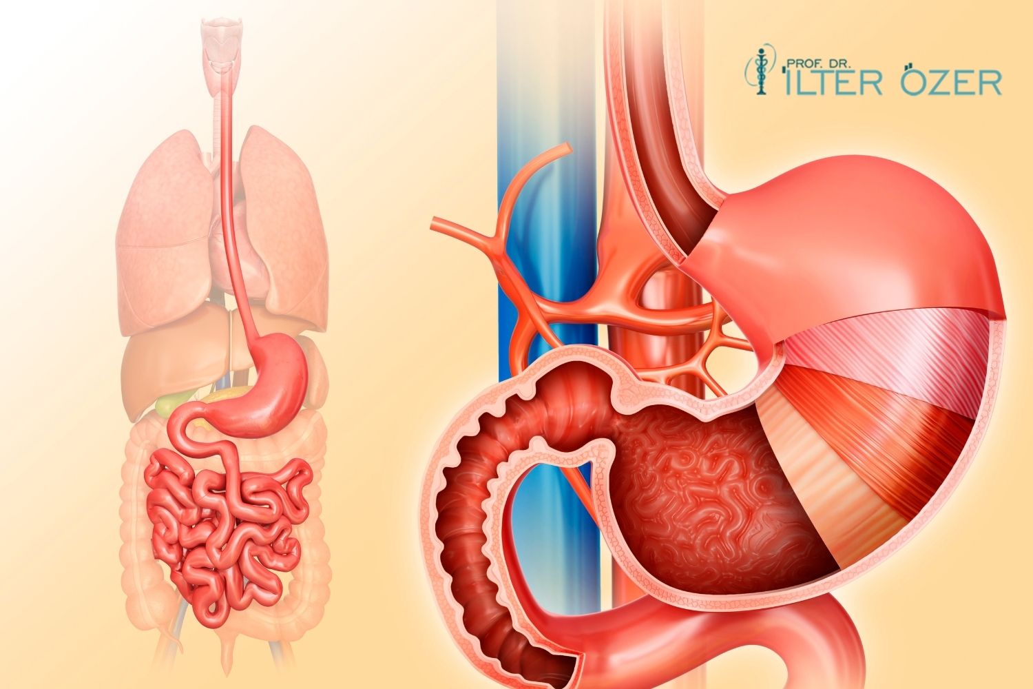 Where Does Stomach Cancer Metastasize?