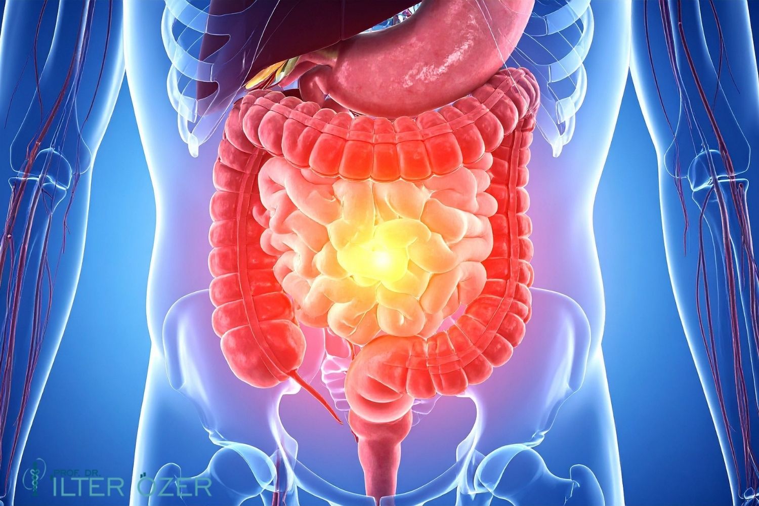 Kolon (Bağırsak) Kanseri Nedir? Belirtileri ve Tedavisi