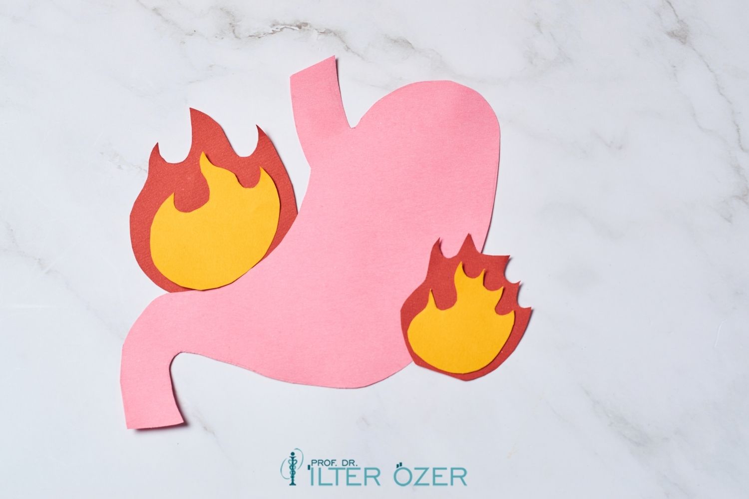 Gastritis and Ulcer Symptoms