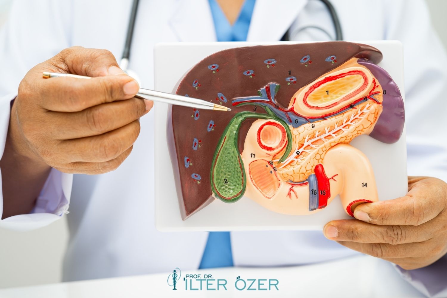 What Is Intraductal Papillary Mucinous Neoplasm (IPMN)?