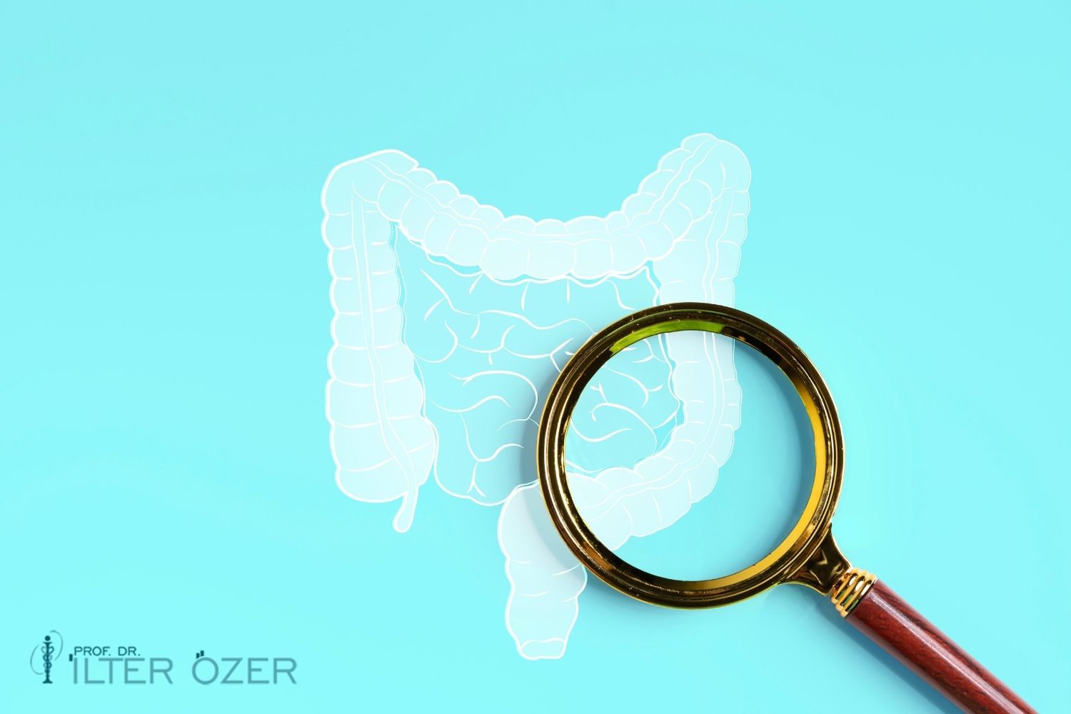 What Is Gastroenterological Surgery and Which Diseases Does It Treat?