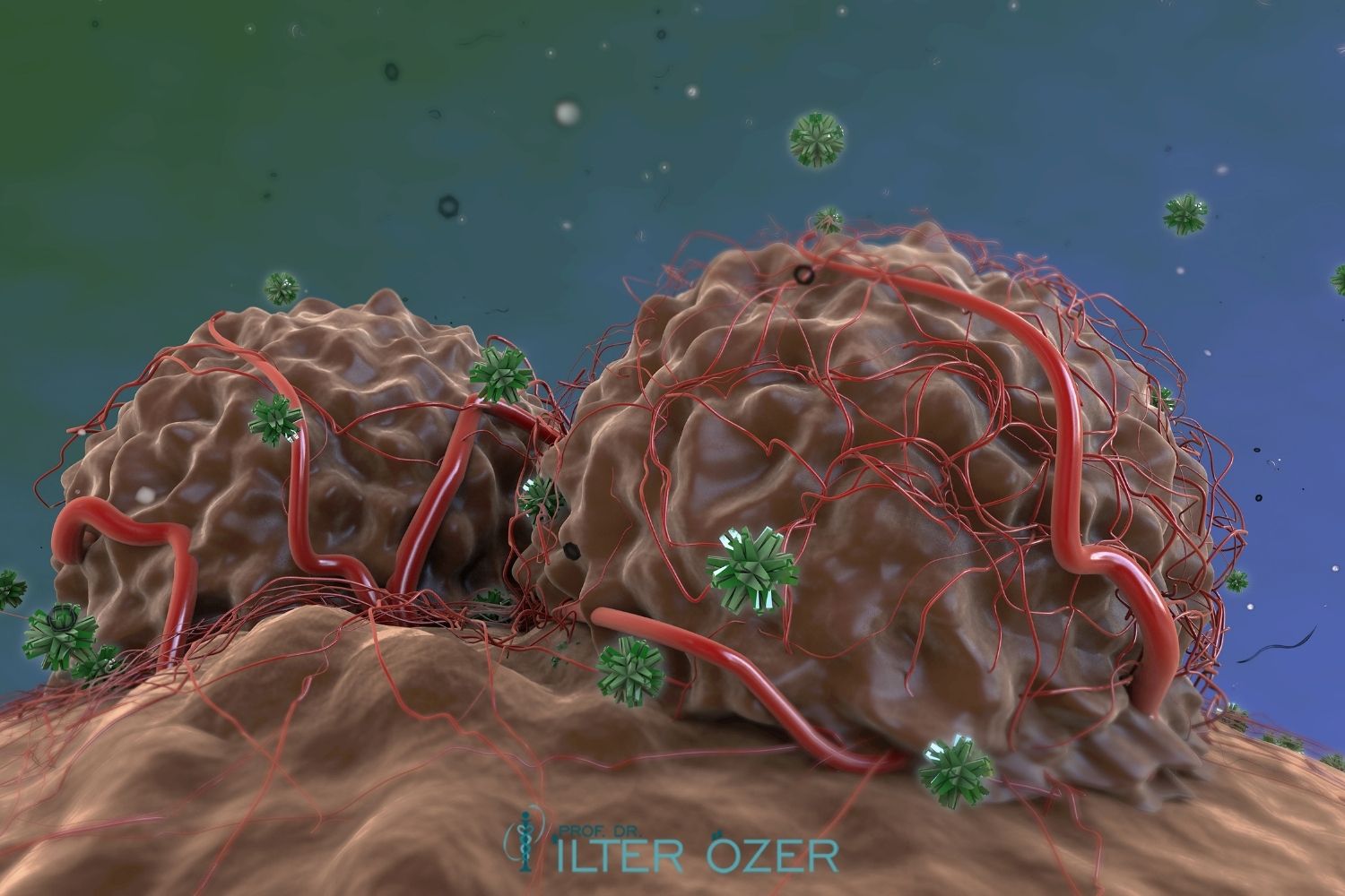 Tumor in the Head of the Pancreas