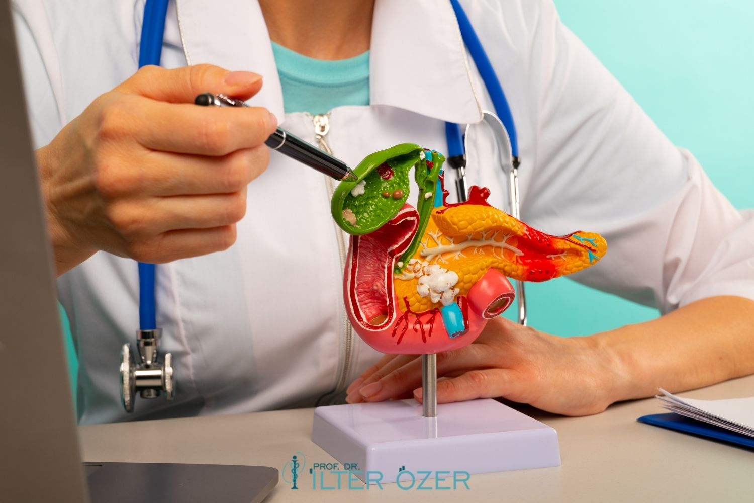 What Is a Pancreatic Cyst? Symptoms and Treatment