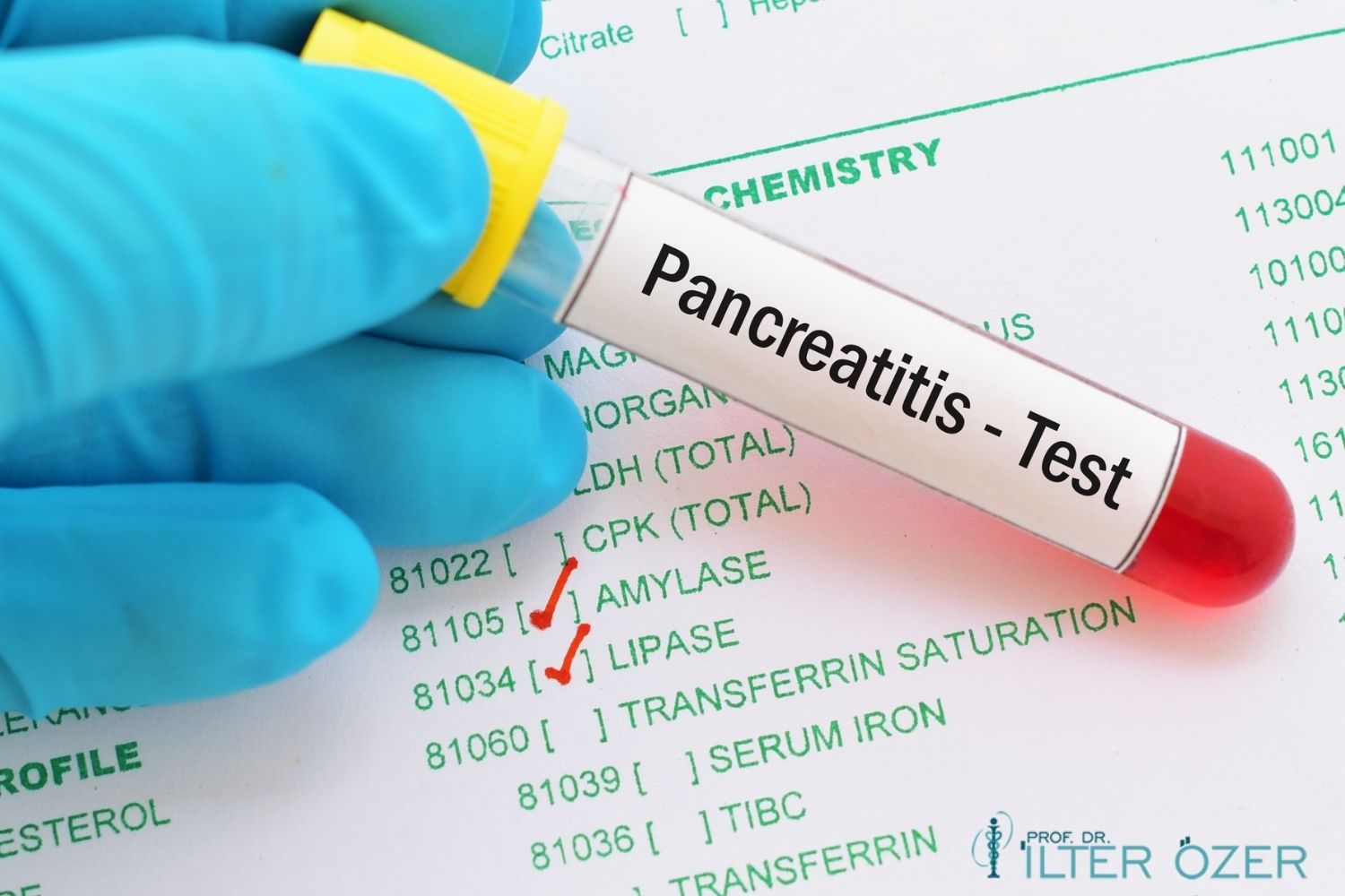 What Is Pancreatic Inflammation (Pancreatitis)? Symptoms and Treatment