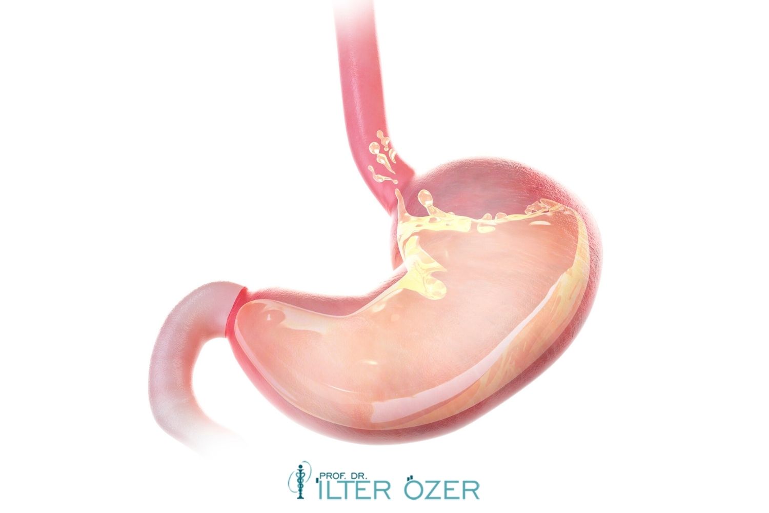 Post-Sleeve Gastrectomy Nutrition