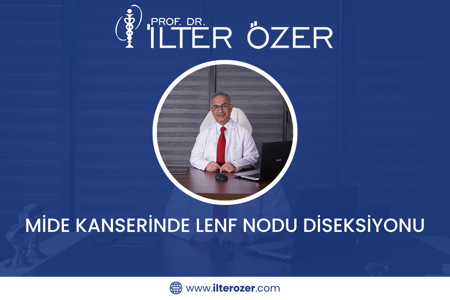 Mide Kanserinde Lenf Nodu Diseksiyonu